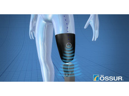 ossur-mind-control-limb.jpg