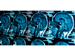 traumatic-brain-injury-650x303.png