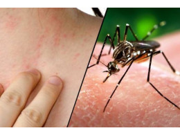 Zika-virus-a-mosquito-borne-600x400.jpg