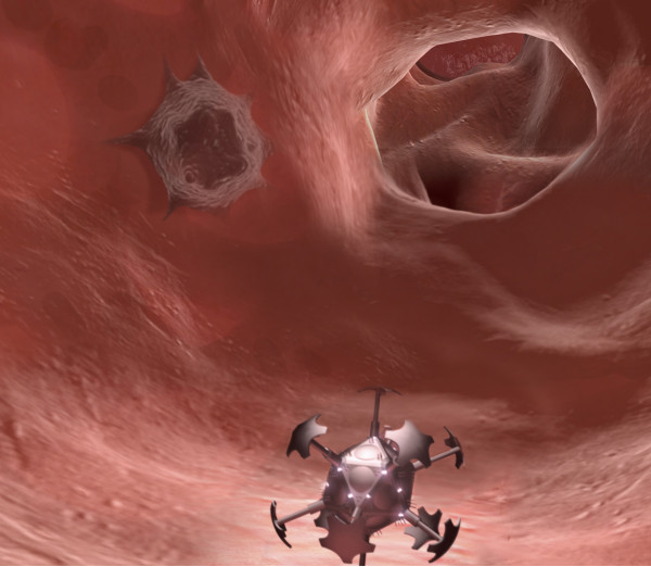btdEM_alveoli